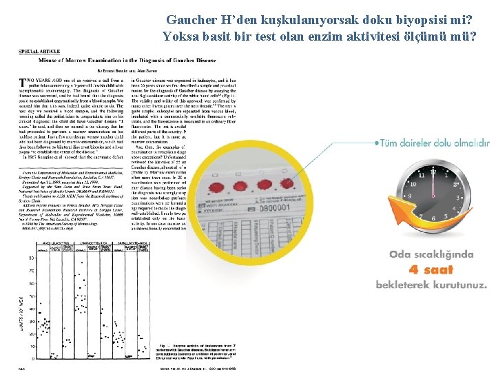 Gaucher H’den kuşkulanıyorsak doku biyopsisi mi? Yoksa basit bir test olan enzim aktivitesi ölçümü