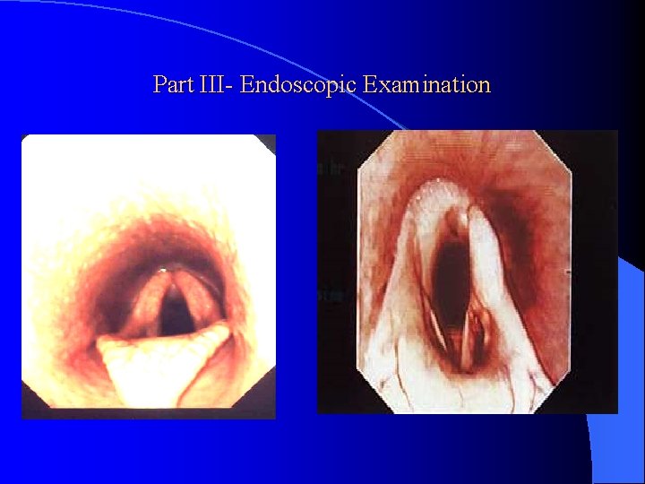 Part III- Endoscopic Examination 