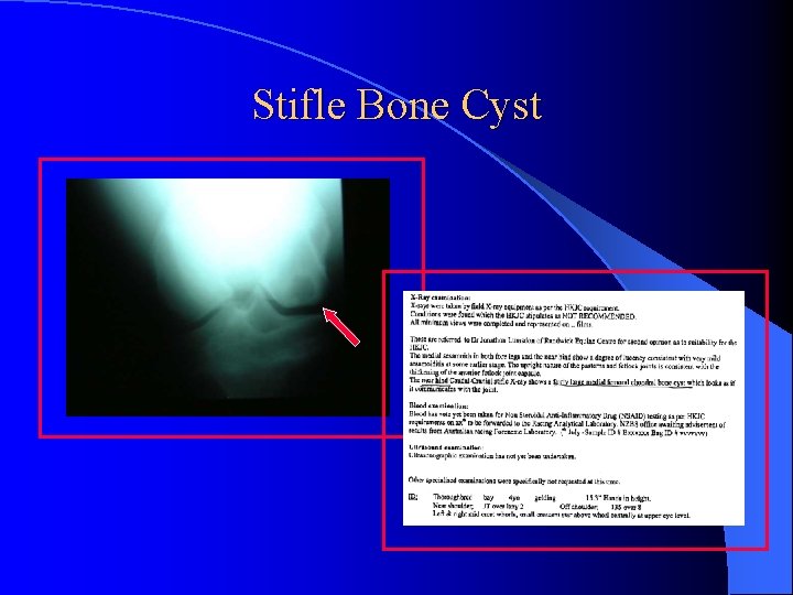 Stifle Bone Cyst 