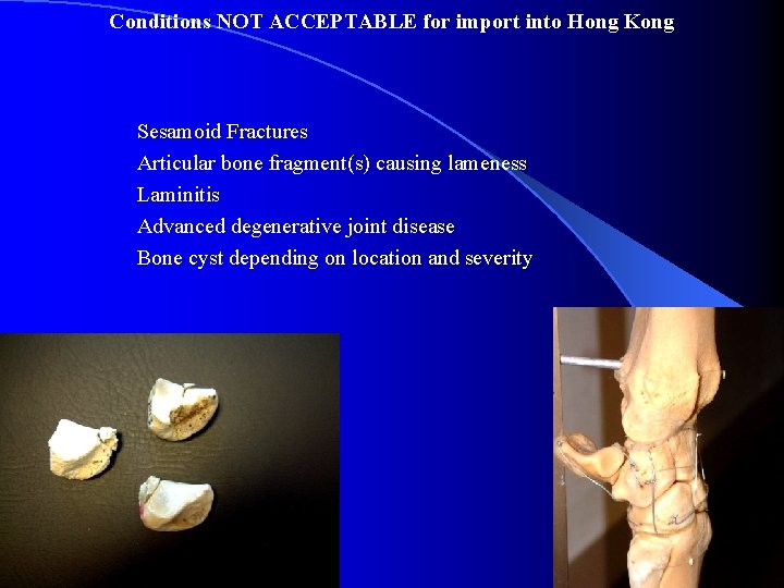 Conditions NOT ACCEPTABLE for import into Hong Kong Sesamoid Fractures Articular bone fragment(s) causing