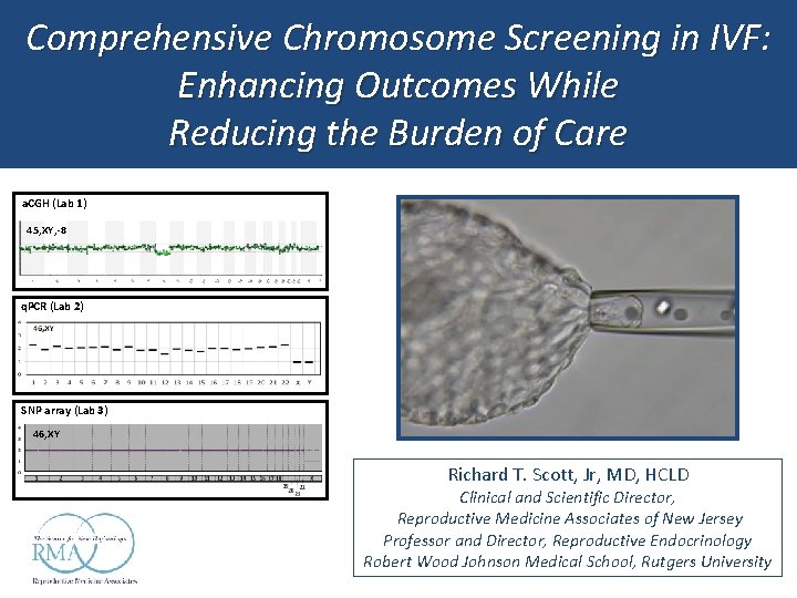 Comprehensive Chromosome Screening in IVF: Enhancing Outcomes While Reducing the Burden of Care a.