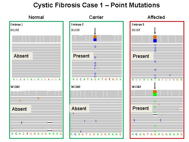 Cystic Fibrosis Case 1 – Point Mutations Normal Carrier Affected Embryo 1 Embryo 2