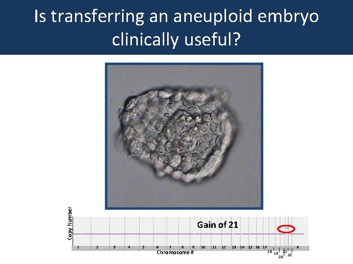 Copy Number Is transferring an aneuploid embryo clinically useful? Gain of 21 1 2
