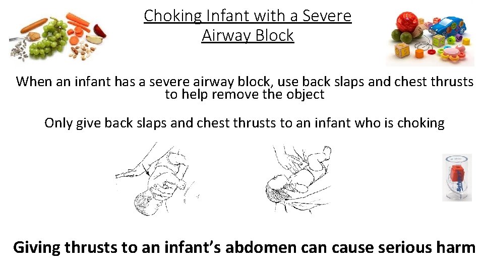 Choking Infant with a Severe Airway Block When an infant has a severe airway