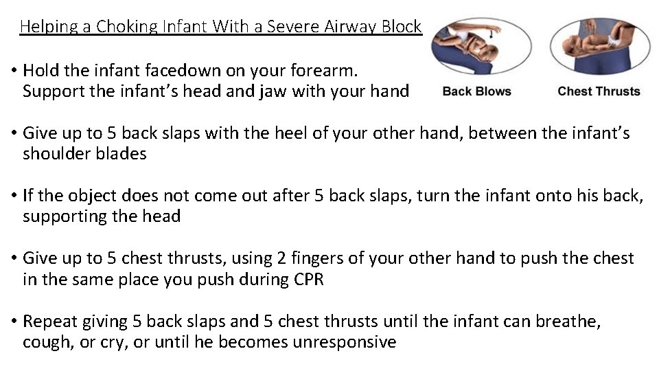 Helping a Choking Infant With a Severe Airway Block • Hold the infant facedown