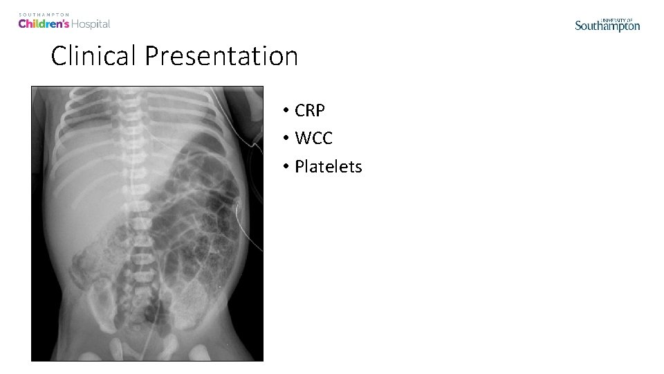 Clinical Presentation • CRP • WCC • Platelets 