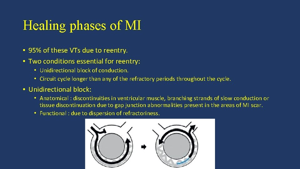 Healing phases of MI • 95% of these VTs due to reentry. • Two