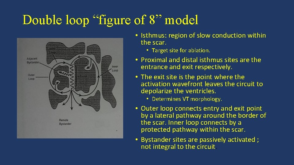 Double loop “figure of 8” model • Isthmus: region of slow conduction within the