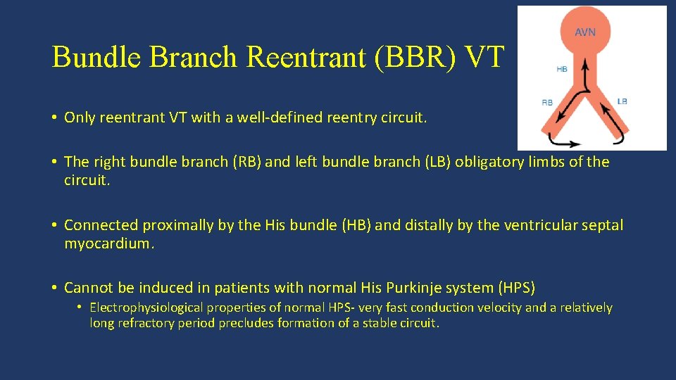 Bundle Branch Reentrant (BBR) VT • Only reentrant VT with a well-defined reentry circuit.
