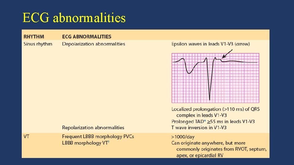 ECG abnormalities 