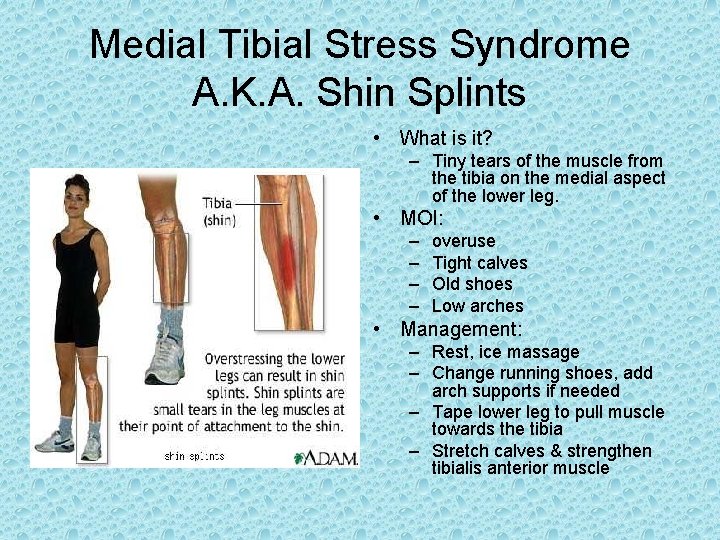 Medial Tibial Stress Syndrome A. K. A. Shin Splints • What is it? – Medial Tibial Stress Syndrome A. K. A. Shin Splints • What is it? –