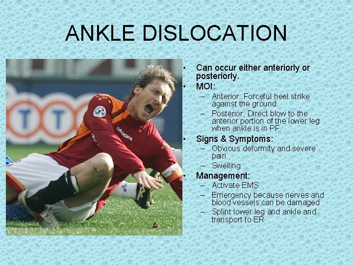ANKLE DISLOCATION • • Can occur either anteriorly or posteriorly. MOI: – Anterior: Forceful ANKLE DISLOCATION • • Can occur either anteriorly or posteriorly. MOI: – Anterior: Forceful