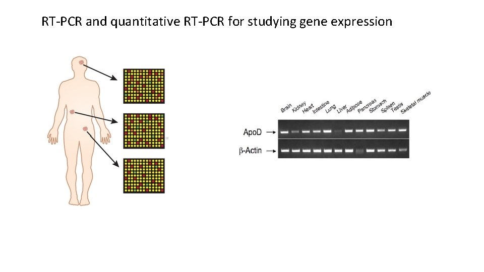 RT-PCR and quantitative RT-PCR for studying gene expression 