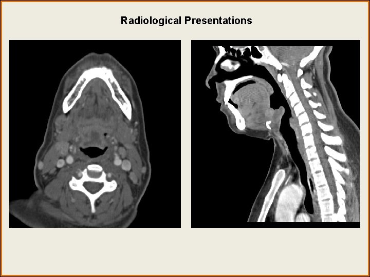 Radiological Presentations Radiological Presentations