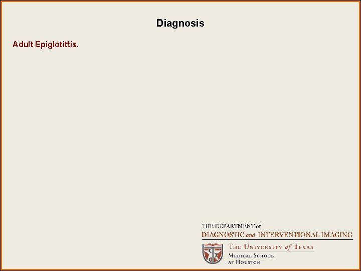 Diagnosis Adult Epiglotittis. Diagnosis Adult Epiglotittis.