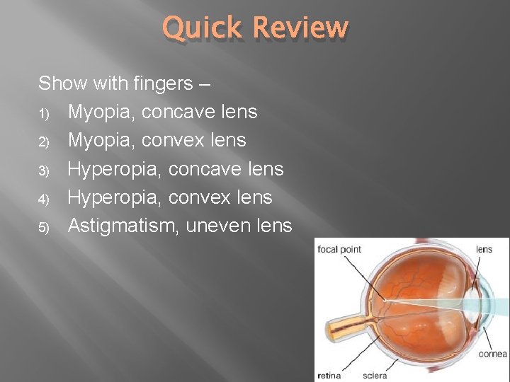 Quick Review Show with fingers – 1) Myopia, concave lens 2) Myopia, convex lens