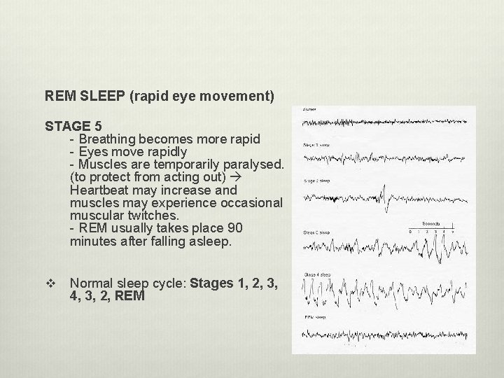 REM SLEEP (rapid eye movement) STAGE 5 - Breathing becomes more rapid - Eyes