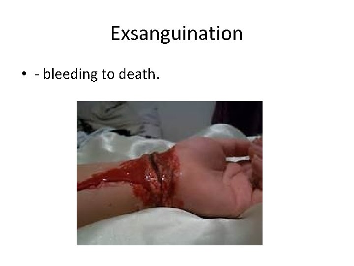 Exsanguination • - bleeding to death. 