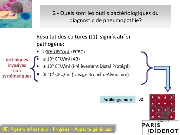 2 - Quels sont les outils bactériologiques du diagnostic de pneumopathie? Résultat des cultures