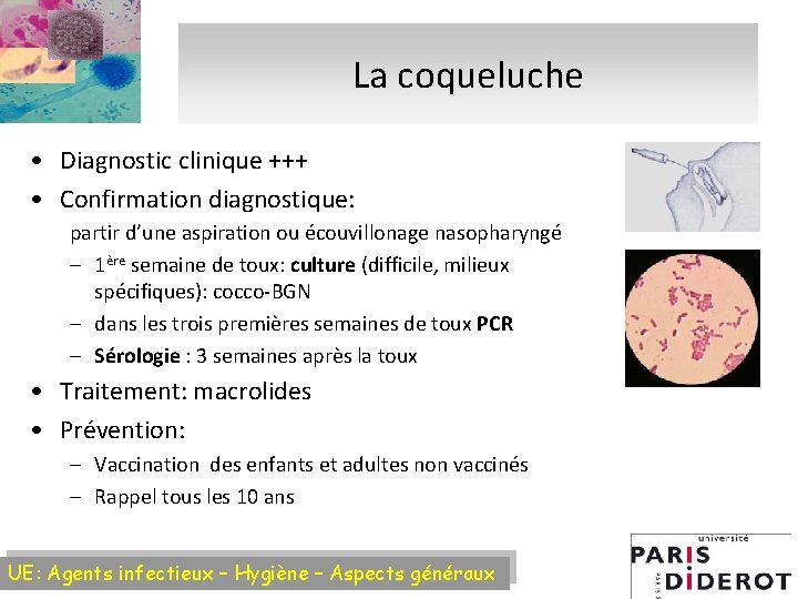 La coqueluche • Diagnostic clinique +++ • Confirmation diagnostique: partir d’une aspiration ou écouvillonage