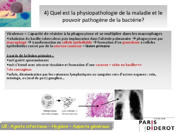 4) Quel est la physiopathologie de la maladie et le pouvoir pathogène de la