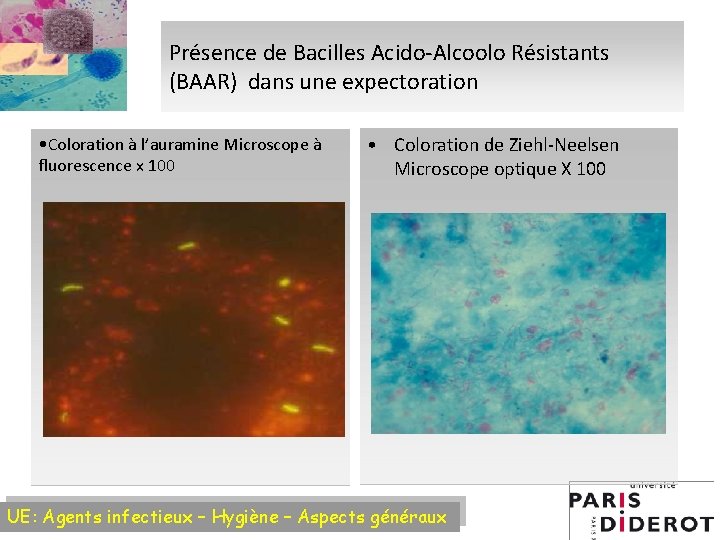 Présence de Bacilles Acido-Alcoolo Résistants (BAAR) dans une expectoration • Coloration à l’auramine Microscope