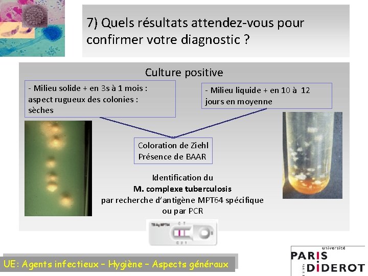 7) Quels résultats attendez-vous pour confirmer votre diagnostic ? Culture positive - Milieu solide