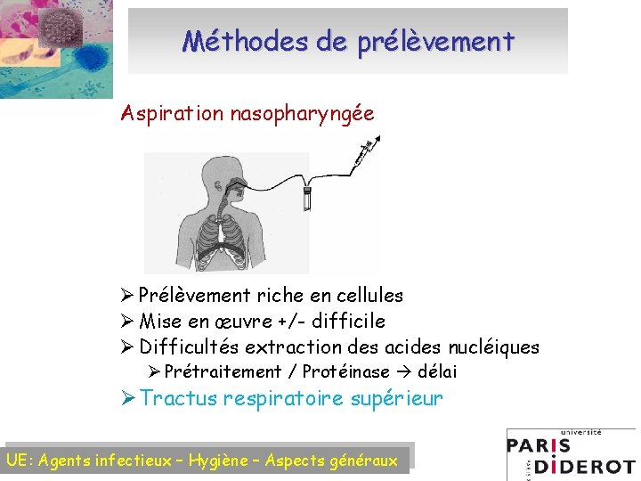 Méthodes de prélèvement Aspiration nasopharyngée Ø Prélèvement riche en cellules Ø Mise en œuvre