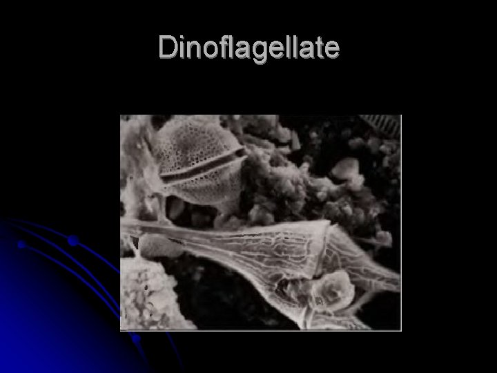 Dinoflagellate 