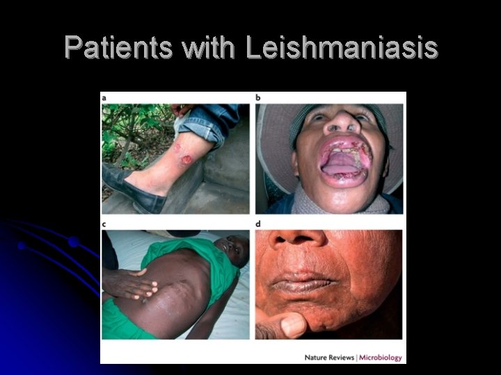 Patients with Leishmaniasis 