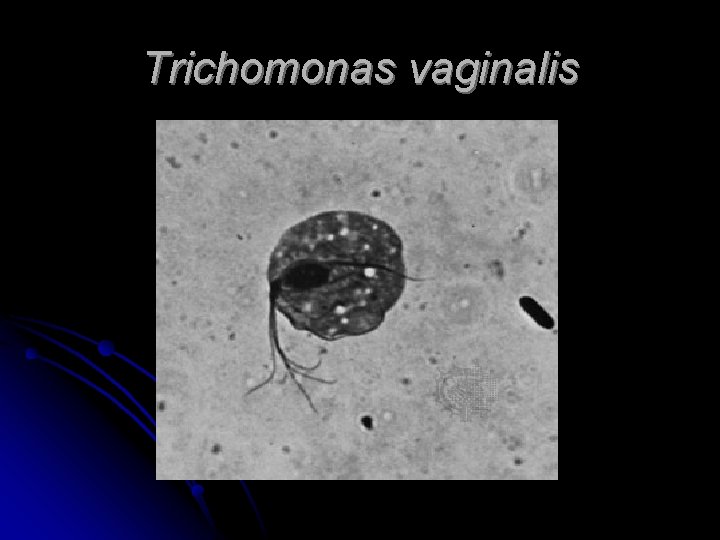 Trichomonas vaginalis 