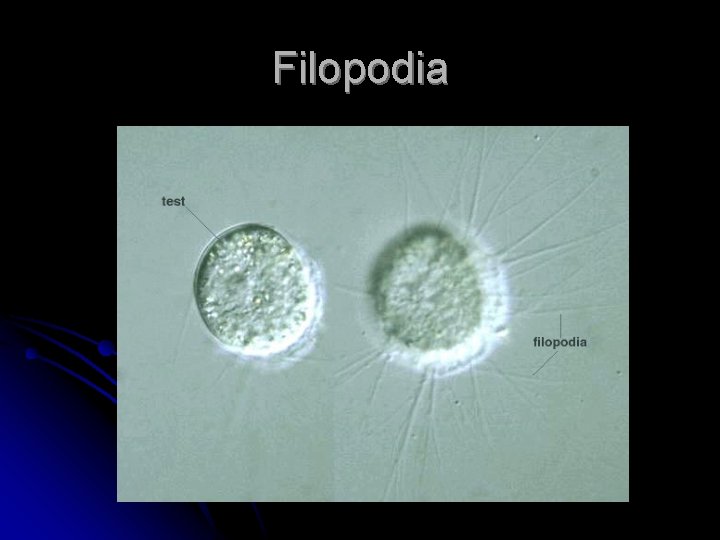 Filopodia 