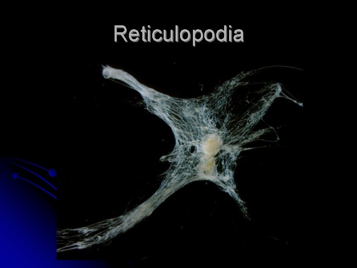 Reticulopodia 