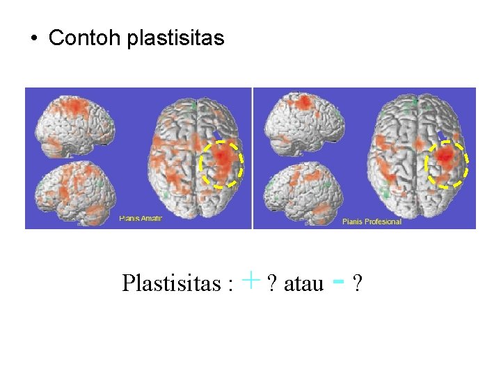  • Contoh plastisitas Plastisitas : + ? atau -? 