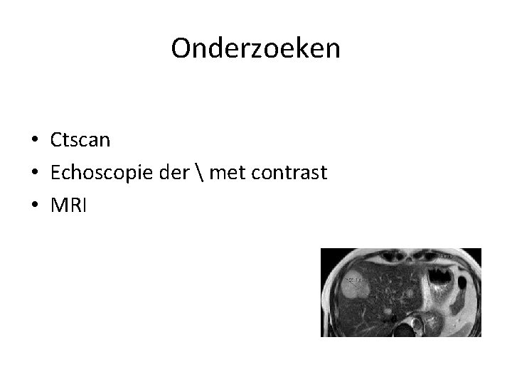 Onderzoeken • Ctscan • Echoscopie der met contrast • MRI Onderzoeken • Ctscan • Echoscopie der met contrast • MRI