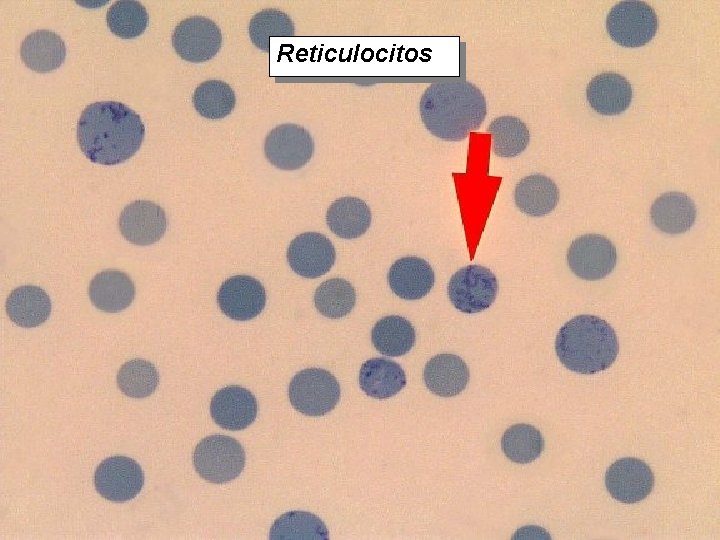 Reticulocitos 