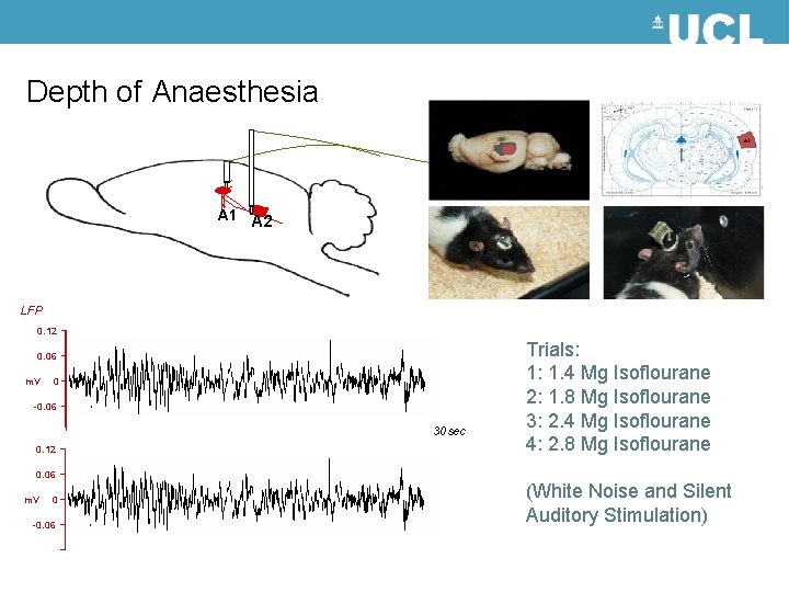 Depth of Anaesthesia A 1 A 2 LFP 0. 12 0. 06 m. V