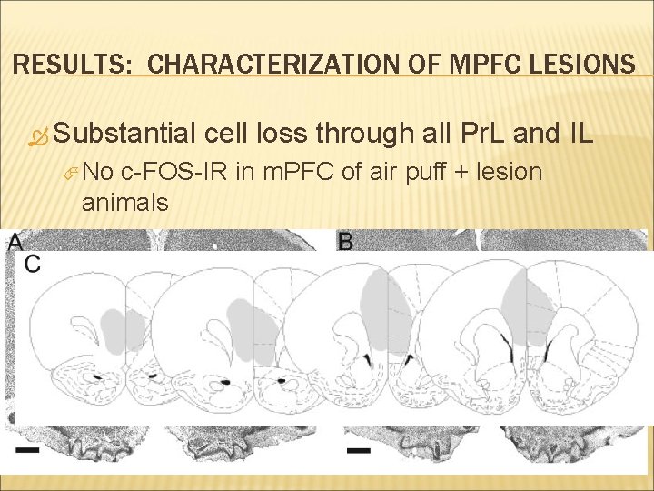 RESULTS: CHARACTERIZATION OF MPFC LESIONS Substantial No cell loss through all Pr. L and