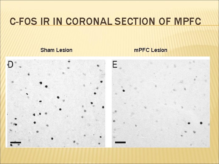 C-FOS IR IN CORONAL SECTION OF MPFC Sham Lesion m. PFC Lesion 