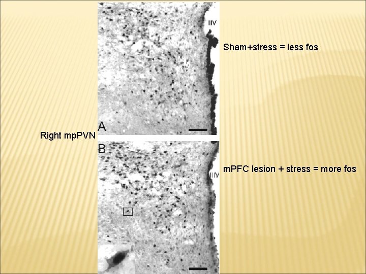 Sham+stress = less fos Right mp. PVN m. PFC lesion + stress = more