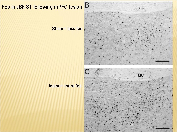 Fos in v. BNST following m. PFC lesion Sham= less fos lesion= more fos