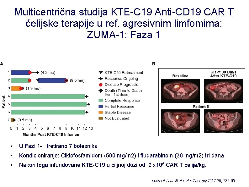 Multicentrična studija KTE-C 19 Anti-CD 19 CAR T ćelijske terapije u ref. agresivnim limfomima: