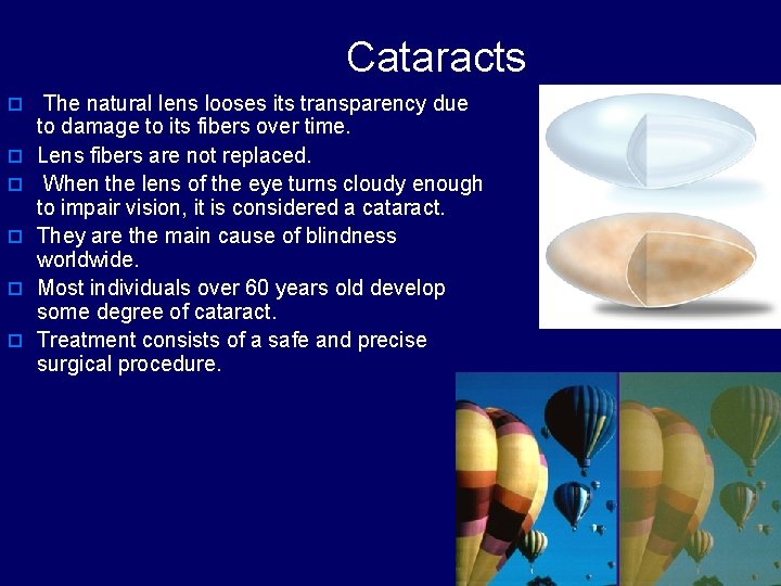 Cataracts o The natural lens looses its transparency due o o o to damage