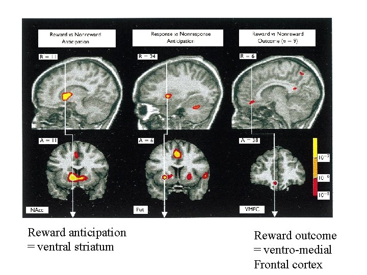 Reward anticipation = ventral striatum Reward outcome = ventro-medial Frontal cortex 