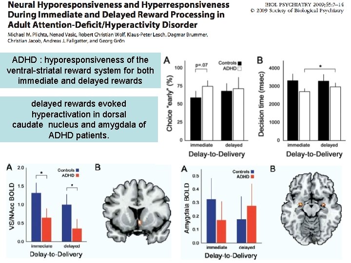 ADHD : hyporesponsiveness of the ventral-striatal reward system for both immediate and delayed rewards
