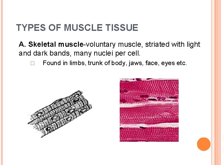 TYPES OF MUSCLE TISSUE A. Skeletal muscle-voluntary muscle, striated with light and dark bands,