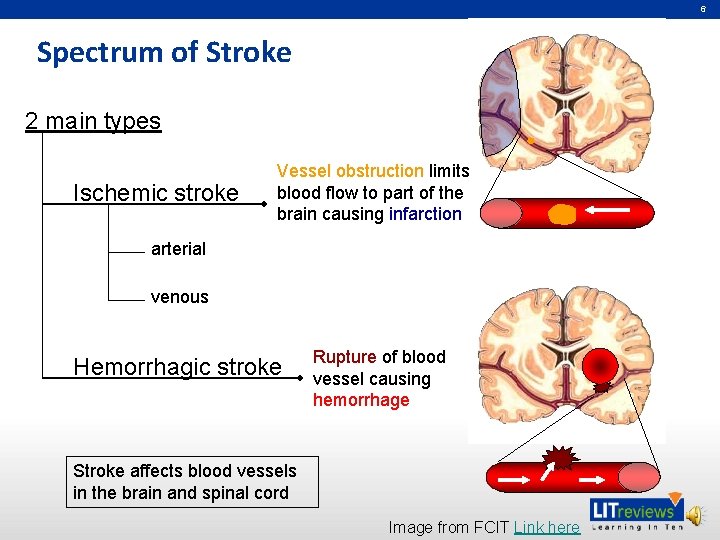 6 Spectrum of Stroke 2 main types Ischemic stroke Vessel obstruction limits blood flow