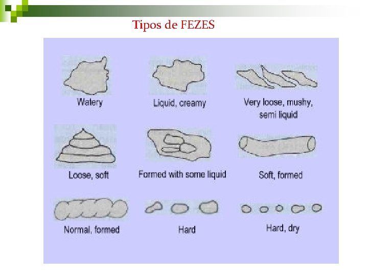 Tipos de FEZES Tipos de FEZES