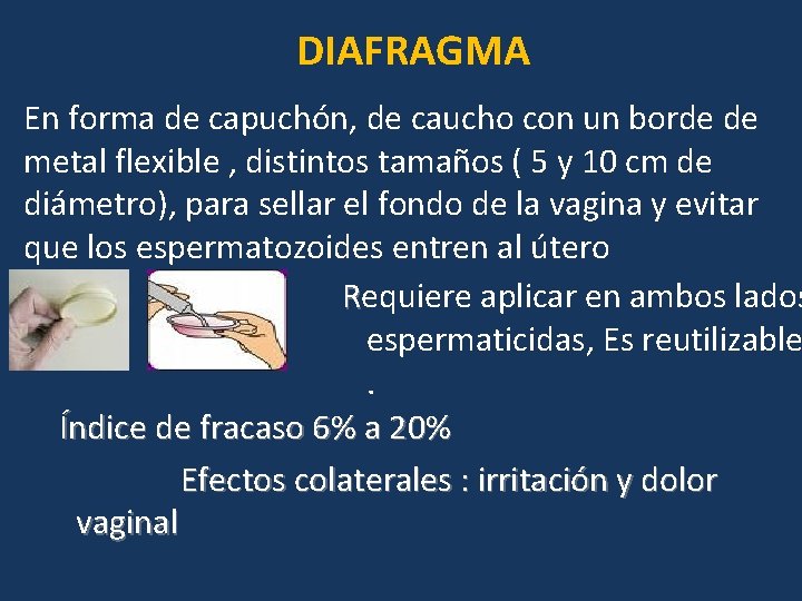 DIAFRAGMA En forma de capuchón, de caucho con un borde de metal flexible ,