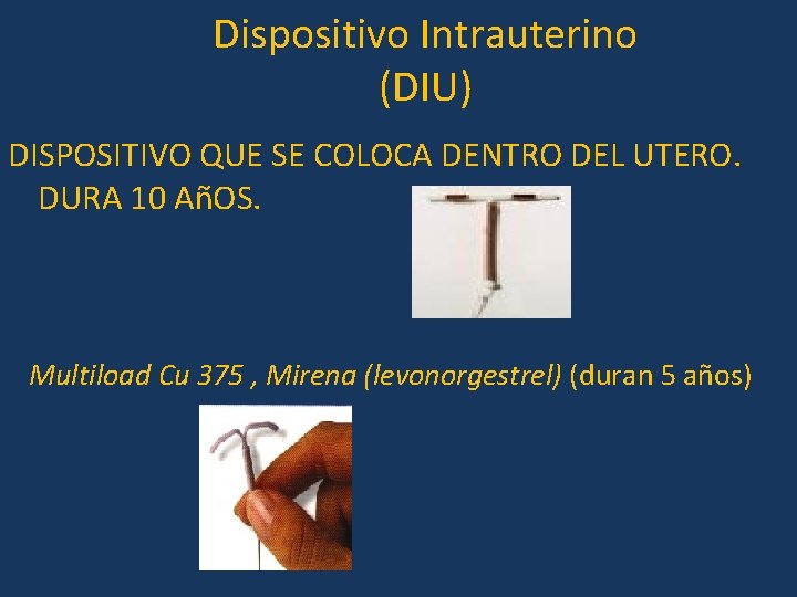 Dispositivo Intrauterino (DIU) DISPOSITIVO QUE SE COLOCA DENTRO DEL UTERO. DURA 10 AñOS. Multiload